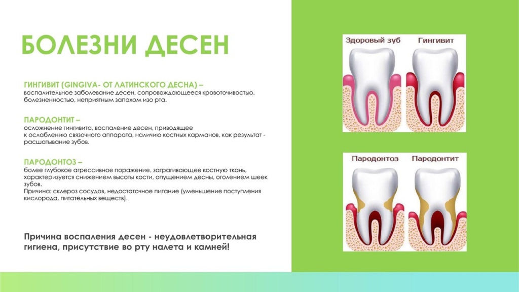 Слайд14.JPG