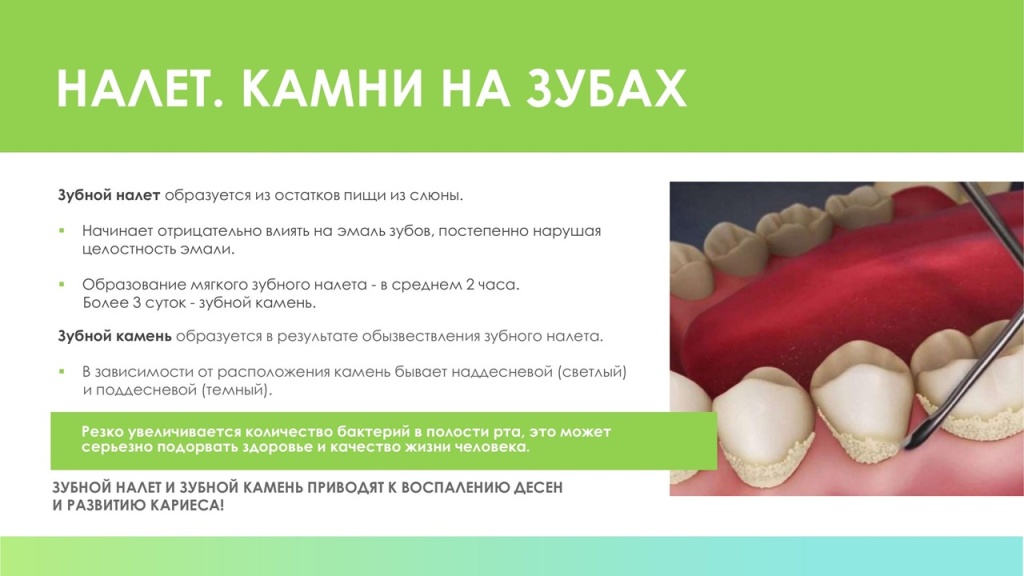 Слайд13.JPG